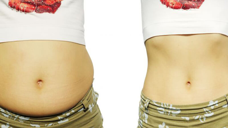 What You Need to Know About Belly Fat and How to Shift It
